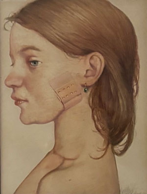 Das kleine Pflaster“, Gottfried HELNWEIN