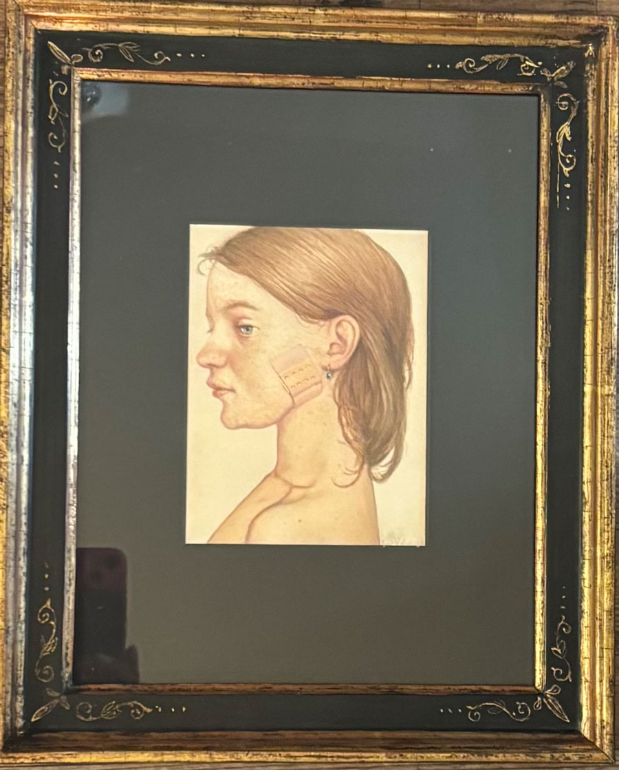 Das kleine Pflaster, Gottfried HELNWEIN